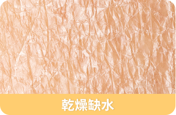 賀多利多乘激活舒敏噴霧 積雪草舒敏精華 乾燥缺水